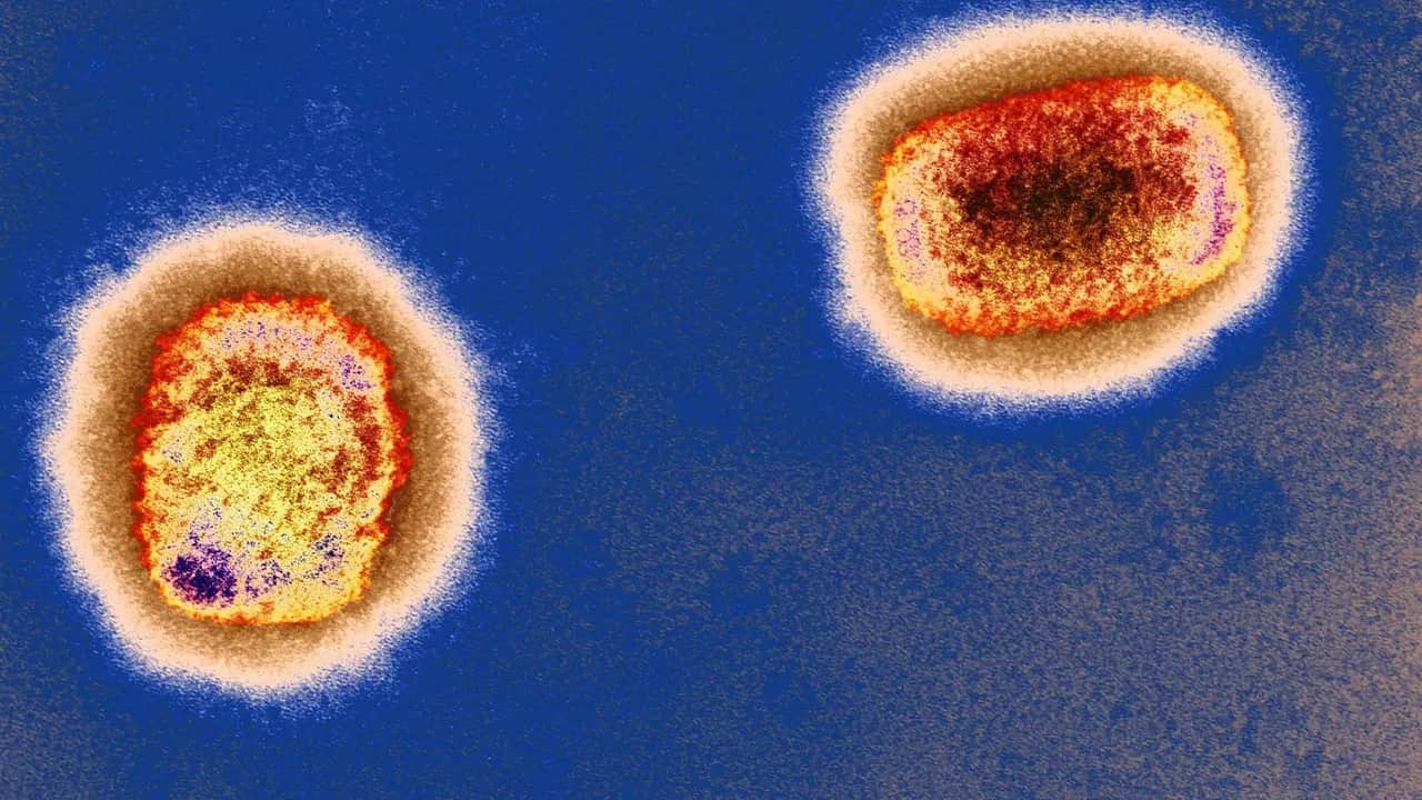 Maroc. Premier cas confirmé de Monkeypox