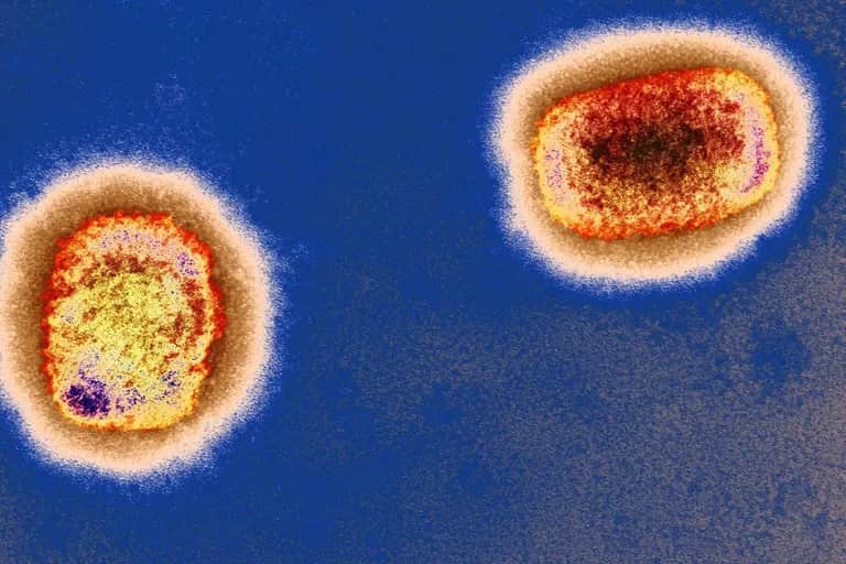 Maroc. Premier cas confirmé de Monkeypox
