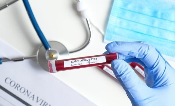 Covid19 : 122 cas confirmés de contamination au lundi 23 mars à 11h