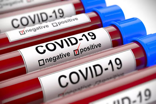 Covid-19: 65 nouvelles guérisons et aucun décès enregistré  le samedi à 10H