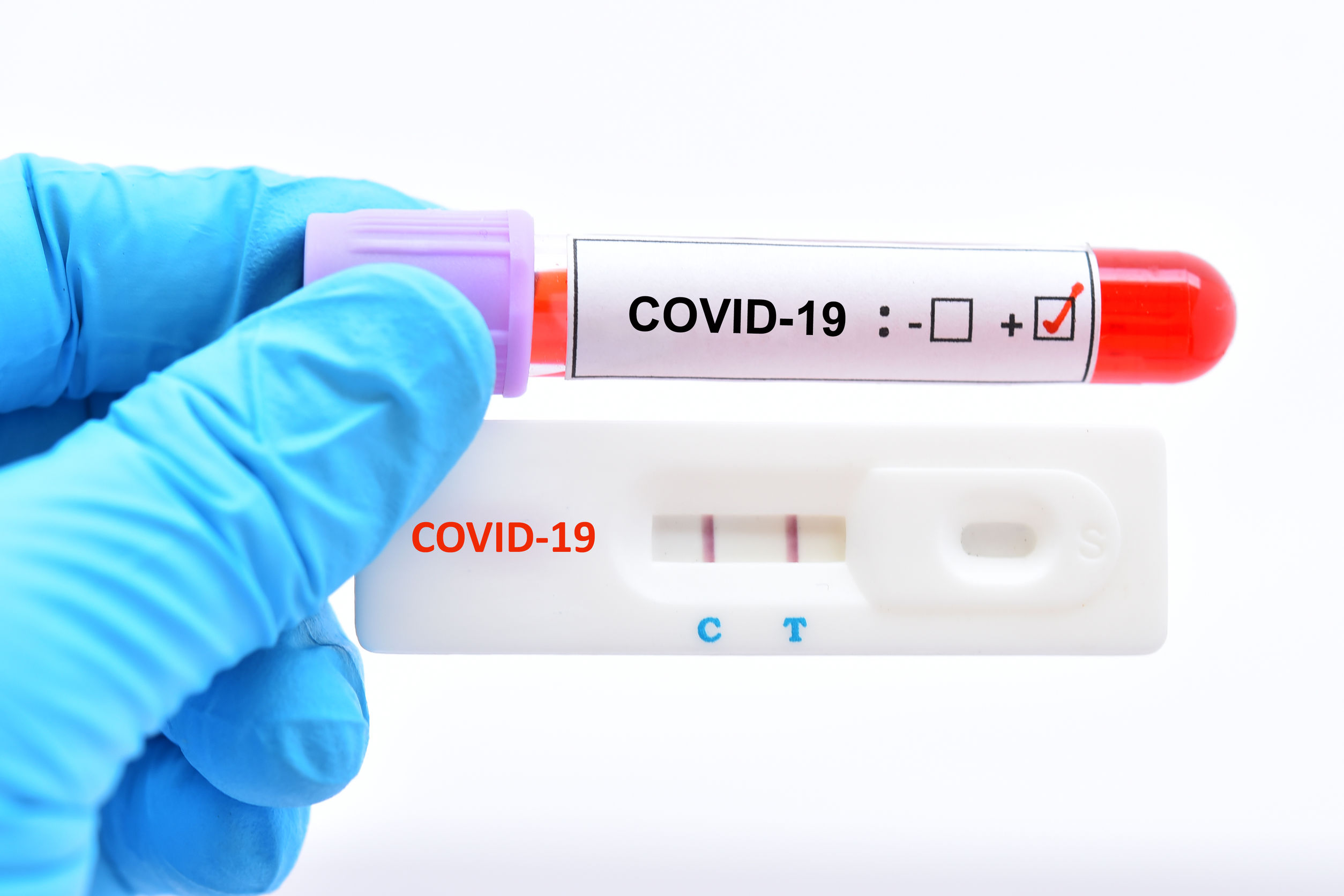 Covid-19 Maroc : Sur instructions du Roi, dépistage massif dans les enteprises