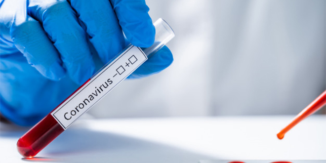 Covid-19 : Avec 45 nouveaux cas, le Maroc franchit le cap des 9.000 contaminations ce jeudi