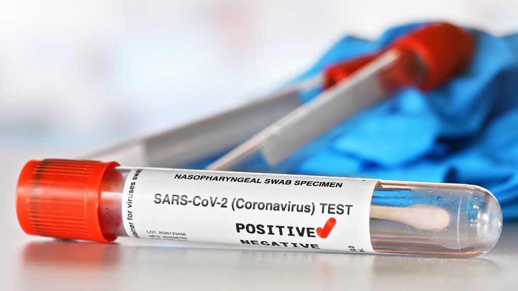 Covid-19: 218 nouvelles contaminations, le jeudi 2 juillet à 10H